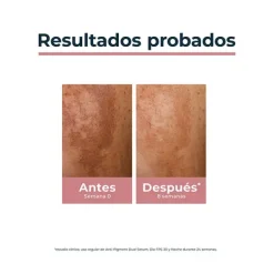EUCERIN Anti-Pigment Dual Serum* Hidratantes Faciales