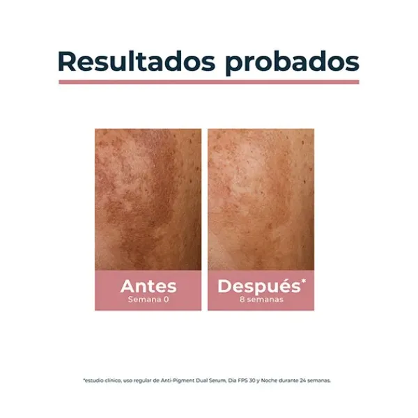 EUCERIN Anti-Pigment Dual Serum* Hidratantes Faciales