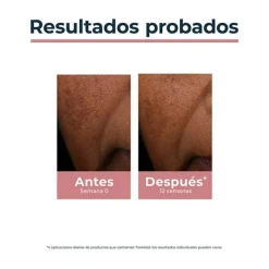 EUCERIN Anti-Pigment Spot Corrector* Hidratantes Faciales